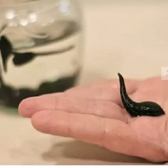 زالو طبی 4تا  7.  پک.  20 عددی